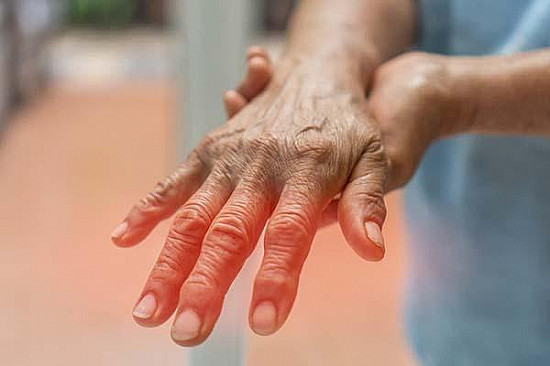 Nerve & Muscle Disorders